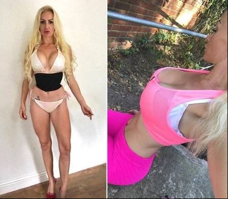 Obcecada pela Barbie vai pagar R$ 76 mil para remover 6 costelas