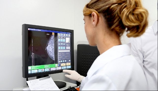 Mamografias periódicas evitam mortes por câncer de mama, diz estudo