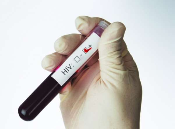 Portador do vírus HIV é curado no Reino Unido e anima pesquisadores