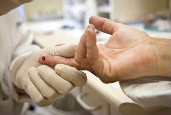 Mundo reduziu quase pela metade as mortes por aids desde 2005, diz ONU