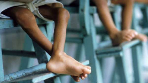 Chega a quase um milhão o numero de crianças em desnutrição aguda na África