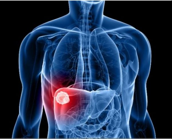 Hepatite B é a mais registrada em Juína