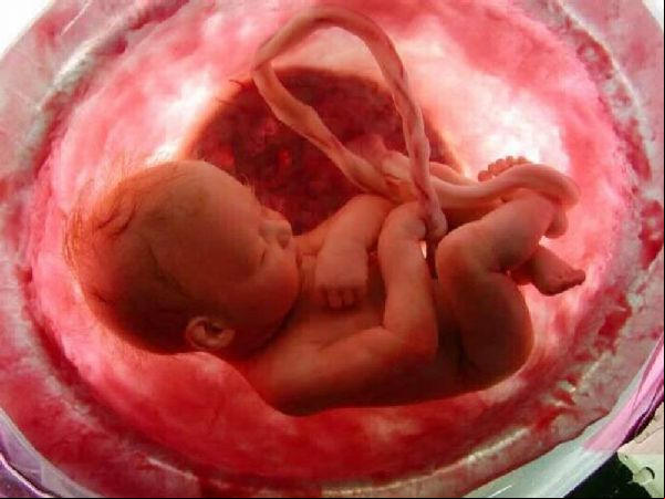 Escola Vinicius de Moraes realiza palestra de prevenção contra o aborto