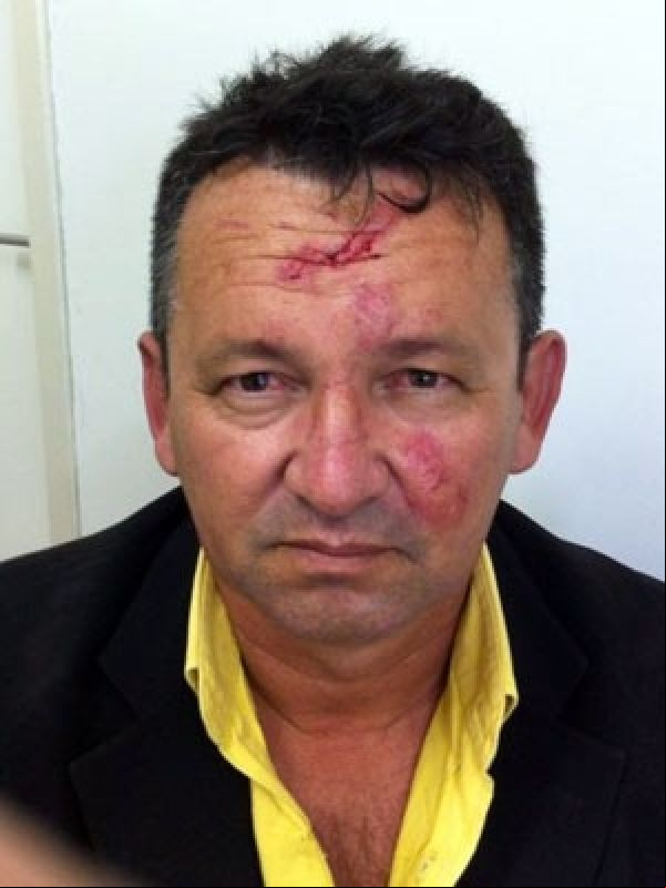 Após sessão, vereador é mordido por ex-prefeito