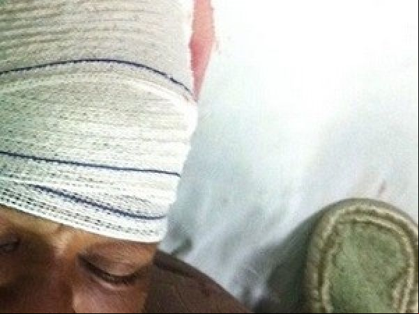 Homem reclama da comida e arranca parte do couro cabeludo da mulher