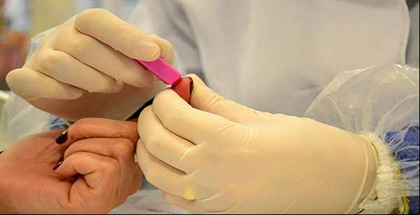 Teste rápido para detectar infecção pelo vírus da hepatite é incluído no SUS