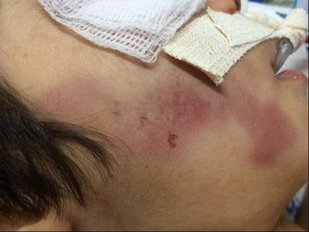 Pai espanca filho de 5 anos porque ele demorou para ir comer e garoto morre