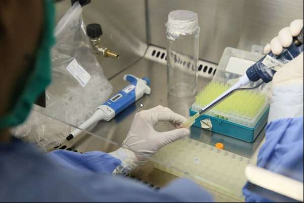 Cepa do vírus da Zika de Guiné-Bissau é diferente da registrada na América