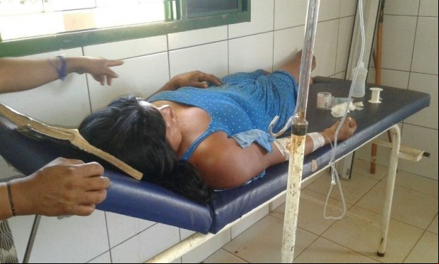Indígenas denunciam descaso feito pelo atendimento da CASAI