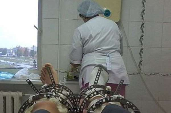 A dolorosa e cara operação para fazer pessoas ficarem mais altas