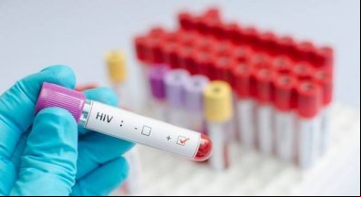 Tratamento brasileiro elimina vírus HIV